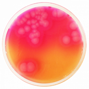 Bacillus Cereus, Agar Base Selectivo (MYP), 500g